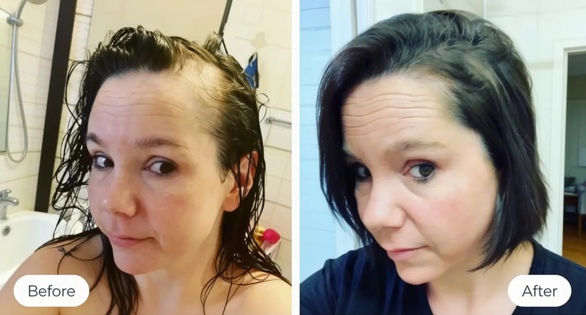 Before and after: Week 1 vs Week 4 hair density progress